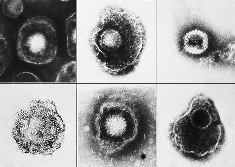 Illustration for article titled Psychedelic Images of Terrifying Viruses